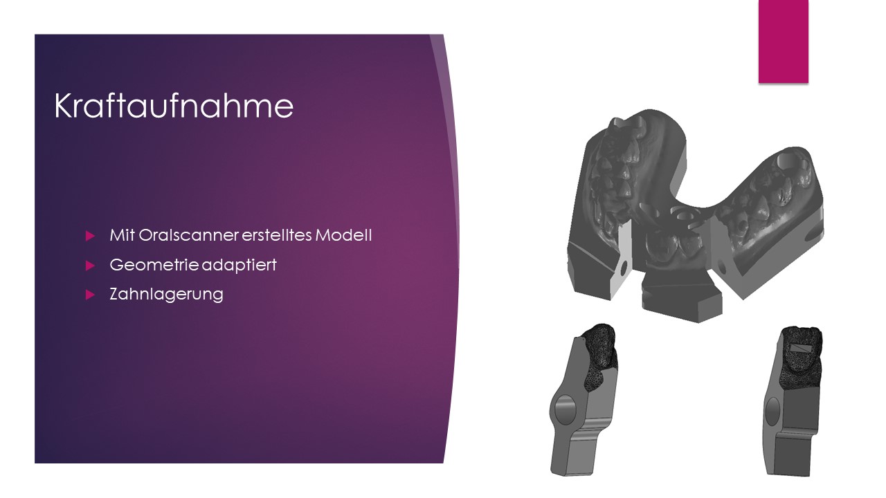 DENTAL MANUFACTURING UNIT Mundschutzprüfstand HTBLuVA Salzburg